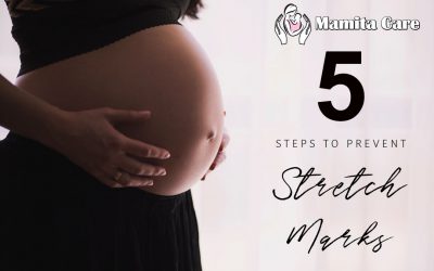 5 Steps To Prevent Stretchmarks During Pregnancy